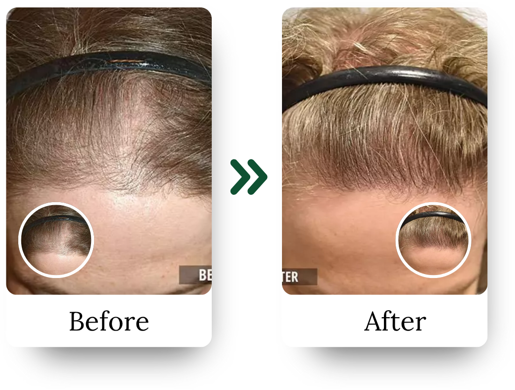 _Hair Treatment Instagram (1)