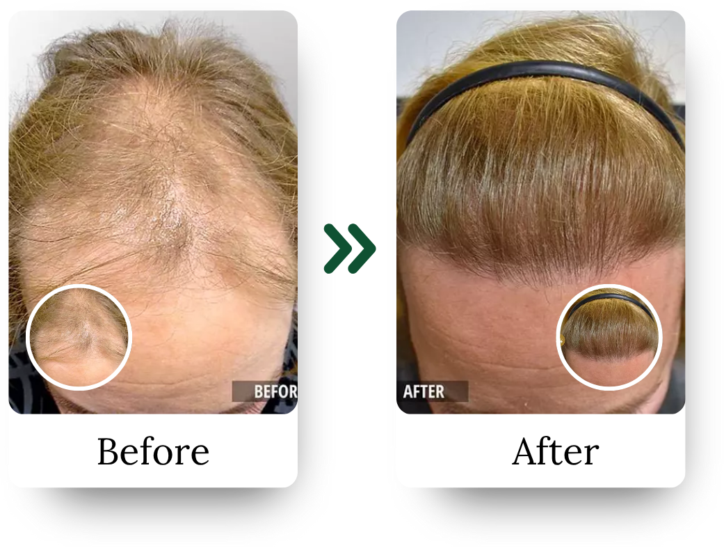 _Hair Treatment Instagram (2)