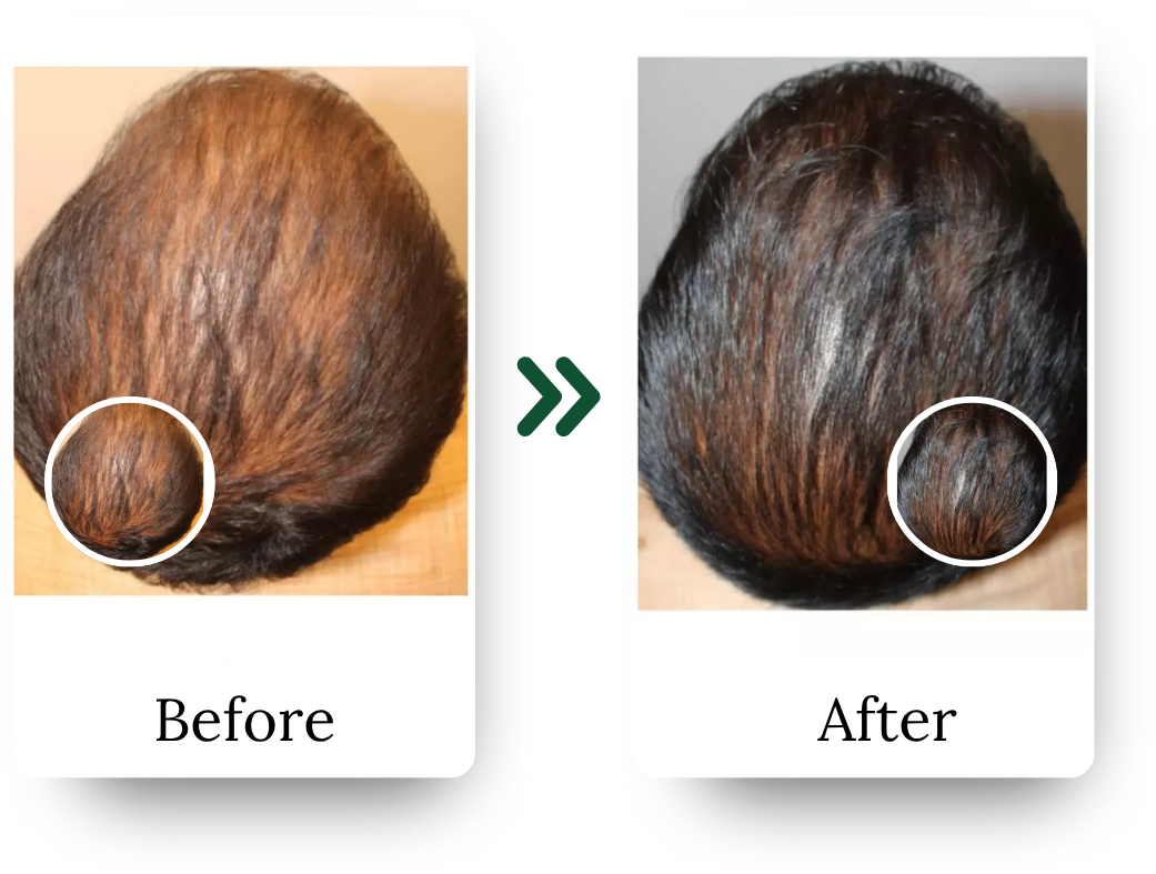 _Hair Treatment Instagram (3)