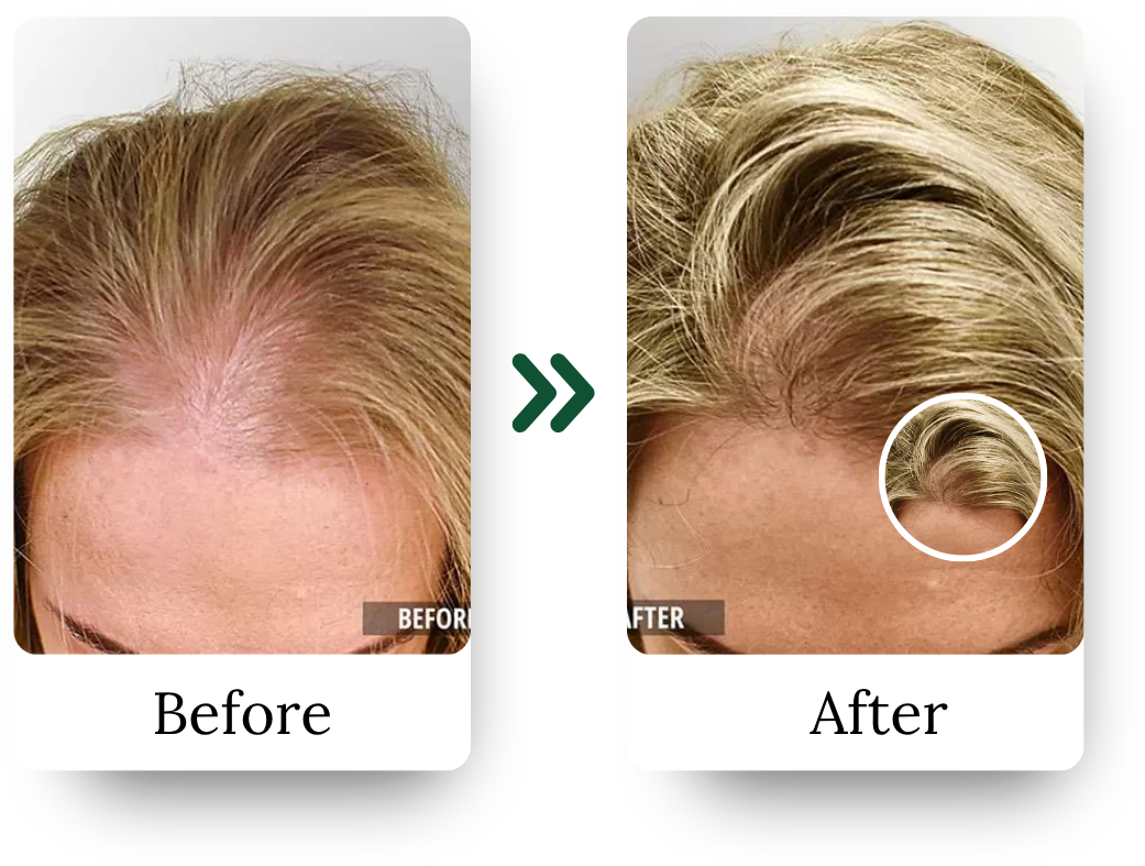 _Hair Treatment Instagram (4)