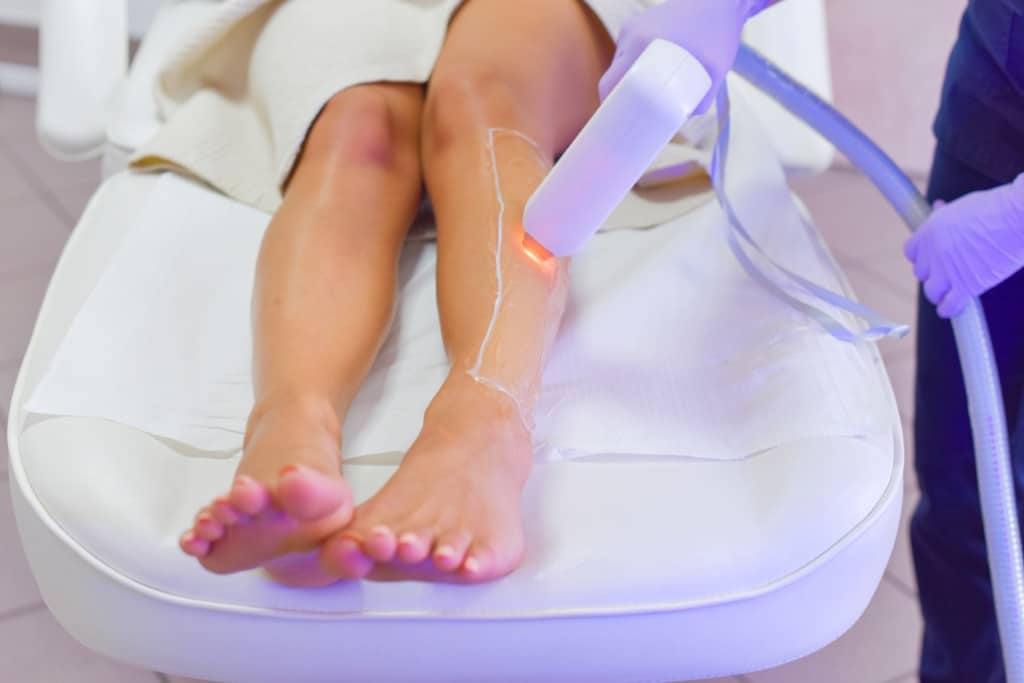 best laser hair removal treatment in Hyderabad