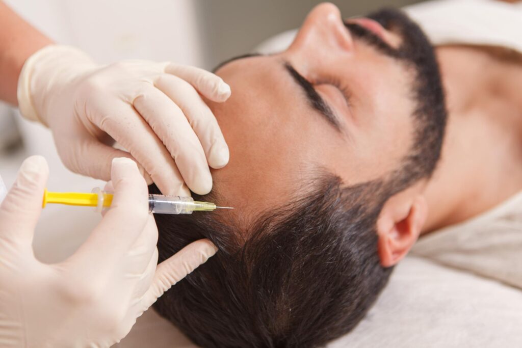 Mesotherapy Treatment in Hyderabad