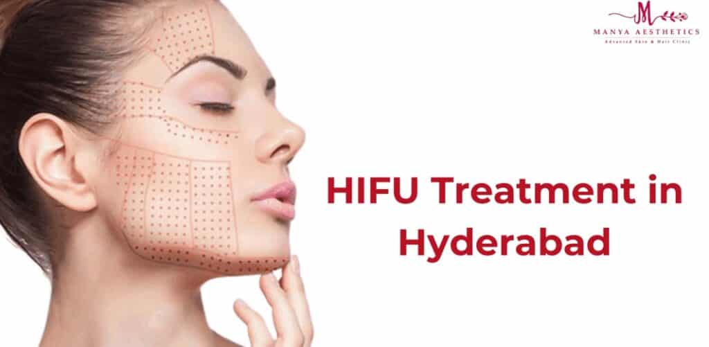 HIFU treatment in hyderabad